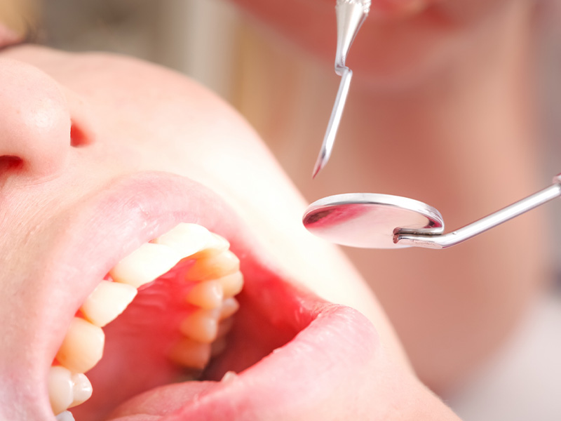 歯科健診を定期的に受けよう！